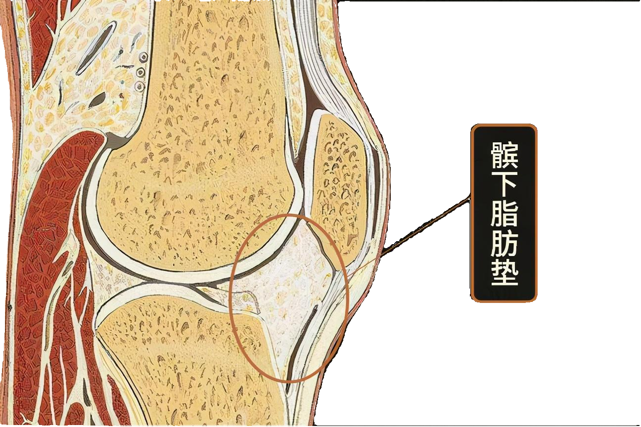 膝盖疼痛？超声波助力髌下脂肪垫炎理疗康复